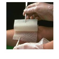 smith nephew garza medicata bactigras con clorexidina acetato 05 10x10cm 10 pezzi ean 5000223074579